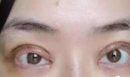 郑州双眼皮厂爆料视频,揭秘整形行业的真实面貌